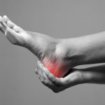 Plantar Fasciitis treatment in queens 